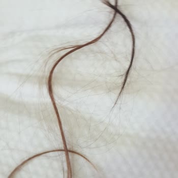 Milli Eğitim Bakanlığı (MEB) Kaynaştırmalı Öğrenci Şiddeti.