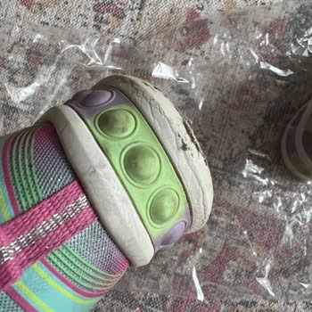 Skechers Marka Ayakkabı Deformasyonu