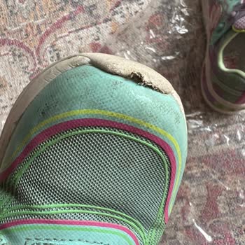 Skechers Marka Ayakkabı Deformasyonu