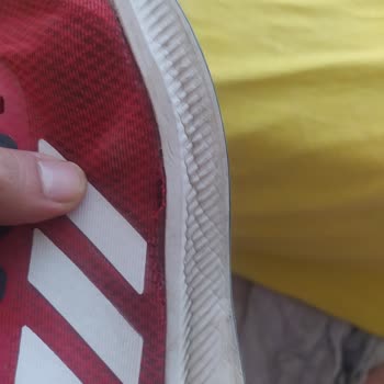 adidas Ayakkabının Garantiye Gitmesi Lazım