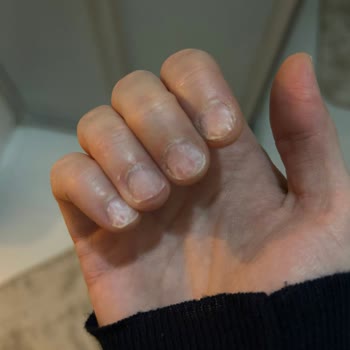 Gratis Beauty Protez Tırnak Çıkartma Faciası