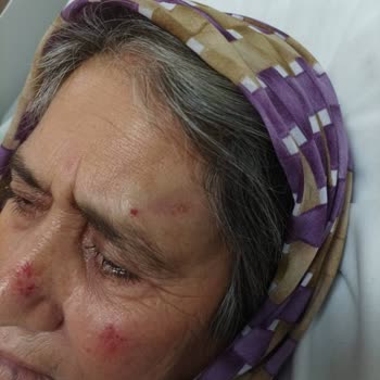 Sağlık Bakanlığı Acil İlgilenecek Bir Durum - İnsanlık Dışı Muamele Ve Tıbbi İhmal