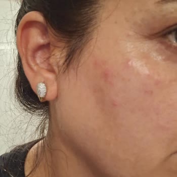 Dilan Polat Pirinç Özlü Sabun Ve Beyazlatıcı Krem Hakkında Şikayetim