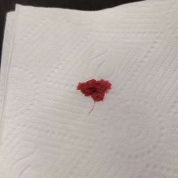 Ronic Nutrition Balçık Benzeri Şey