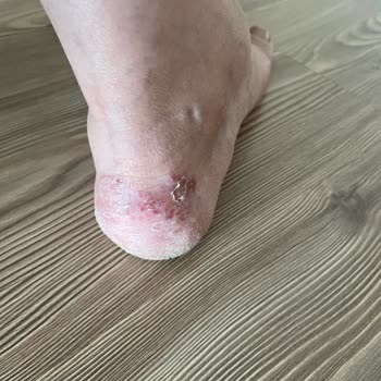 Skechers Ayakkabı Ürününde Hatayı Kabul Etmiyor