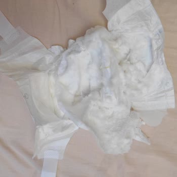 Sleepy Bionatural Ve Natural Bebek Bezi Pişik Yaptı