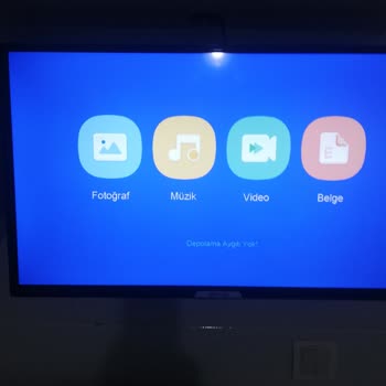 Onvo Media Tuşuna Basınca Bir Daha Da TV Programına Geri Dönemedim