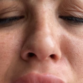 Dr. Engin Duruk Nişantaşı Yamuk Dudaklar, Tutmayan Botoxlar, İlgisiz Dr.