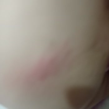 BİM Jenny Willy Bebek Bezi İle İlgili Şikayet