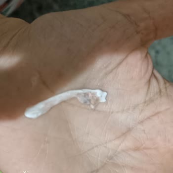 İçim Ayrandan Yumurta Akı Benzeri Bir Şey Çıktı