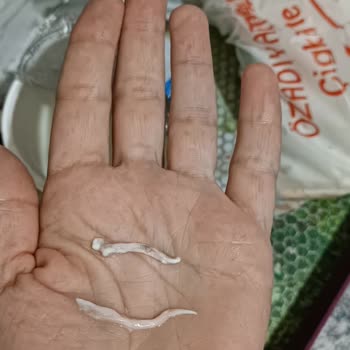 İçim Ayrandan Yumurta Akı Benzeri Bir Şey Çıktı
