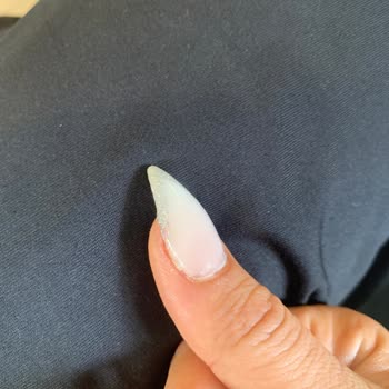 Pendik Protez Tırnak Sevgi Özdemir Saygısız İşletme