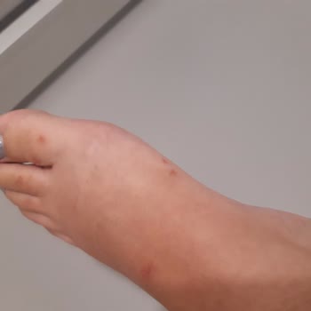 Deichmann Müşteri Memnuniyeti Nerede?