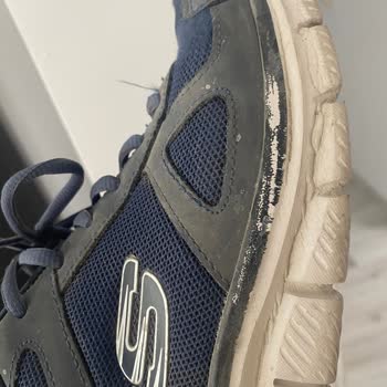 Skechers Geri İade Talebi