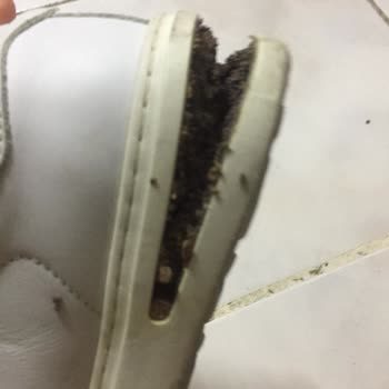 Form Medikal Sağlık Birkenstock Tabanı Düşen Ayakkabı Değişimi Yapmadı!
