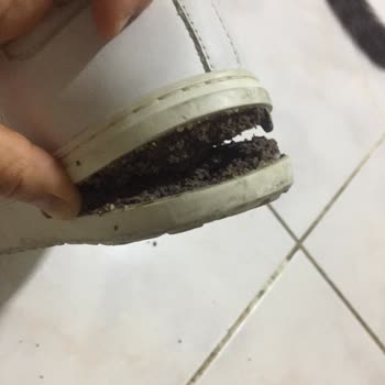 Form Medikal Sağlık Birkenstock Tabanı Düşen Ayakkabı Değişimi Yapmadı!