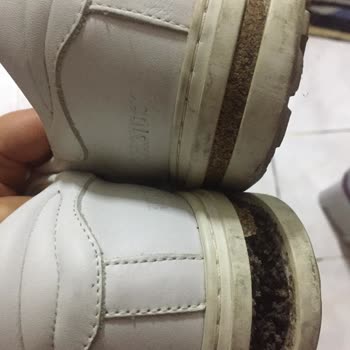 Form Medikal Sağlık Birkenstock Tabanı Düşen Ayakkabı Değişimi Yapmadı!