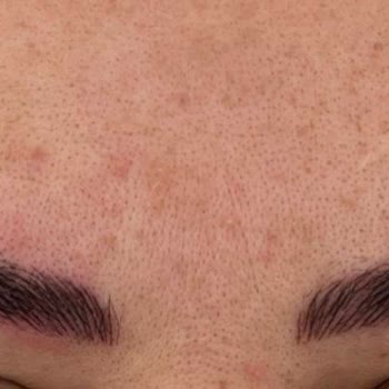 Aris Güzellik Merkezleri Aris Antalya Vip Merkezi Ticari Kaygı İle Sizi Tehlikeye Atıyor