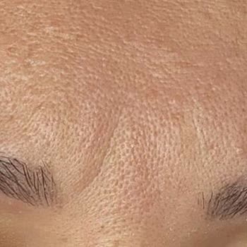 Aris Güzellik Merkezleri Aris Antalya Vip Merkezi Ticari Kaygı İle Sizi Tehlikeye Atıyor