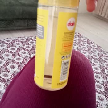 Dalin Bebek Kolonyasında Böcek Çıktı!