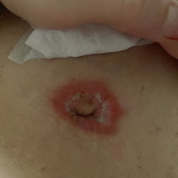 Asya Hastanesi Ameliyathanenin Pisliğinden Ölüyordum