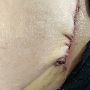 Asya Hastanesi Ameliyathanenin Pisliğinden Ölüyordum