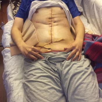 Asya Hastanesi Ameliyathanenin Pisliğinden Ölüyordum