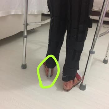 Denge Ortopedi Beşiktaş Malının Arkasında Durmuyor