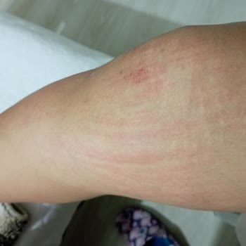 Neslim Güngen Güzellik Kırklareli Şubesi Müşteri Mağduriyeti