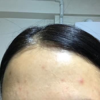 Watsons Mağazasında Yapamadığım İade