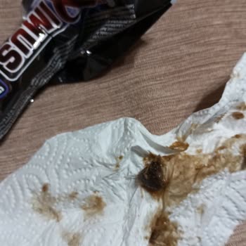 Eti Gıda Maxımus Ürününde Çıkan Sert Ürün