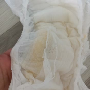 Molfix Pure Soft Sızdırma
