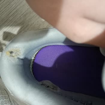 Skechers Ayakkabı Kalitesi Ve Garanti Süreci