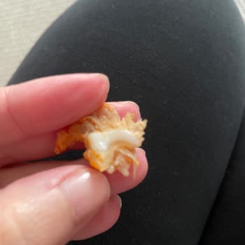 Tavuk Fakültesi Yabancı Cisim Çıkması