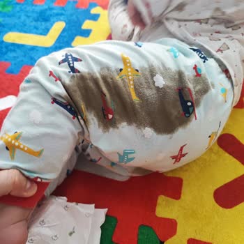 Molfix Bebek Bezi Yeni Nesil