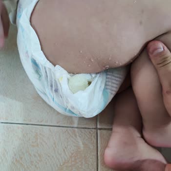 Molfix Bebek Bezi Yeni Nesil