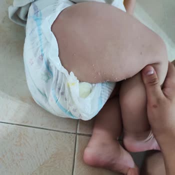 Molfix Bebek Bezi Yeni Nesil