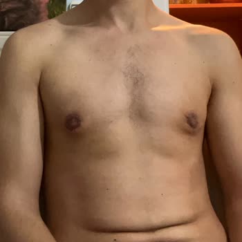 Op. Dr. Yağmur Reyyan Erol Jinekomasti Ameliyatı