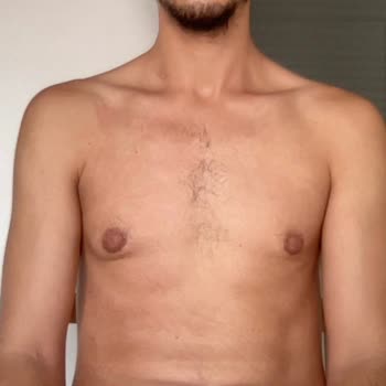 Op. Dr. Yağmur Reyyan Erol Jinekomasti Ameliyatı