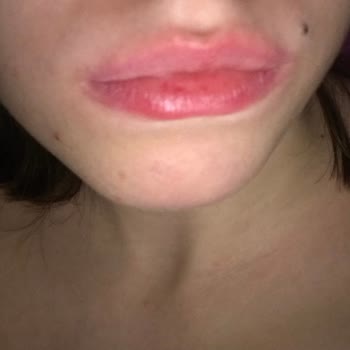 Flormar Lip Stain Alerji Ve Yanma Yaptı