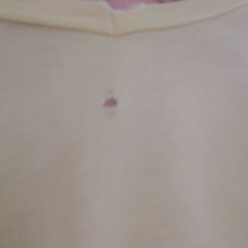 Siemens Çamaşır Makinesi Kıyafetleri Yırtıp Bozuyor