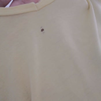 Siemens Çamaşır Makinesi Kıyafetleri Yırtıp Bozuyor