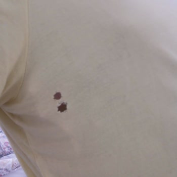 Siemens Çamaşır Makinesi Kıyafetleri Yırtıp Bozuyor