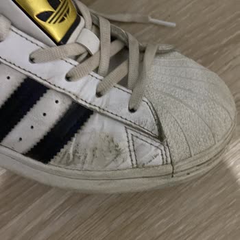 Adidas'tan Aldığım Ayakkabı Yüzünden Mağdurum