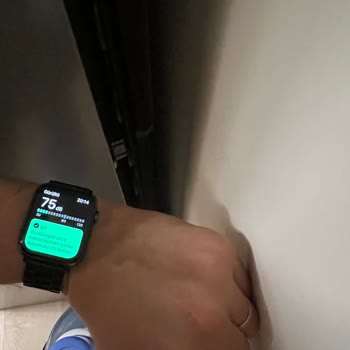 Siemens Servisi Ürün Hatasını Kabul Etmiyor.