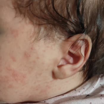 Mustela Cleansing Yenidoğan Şampuanı Ve Stelatopia Krem Pişmanlıktır