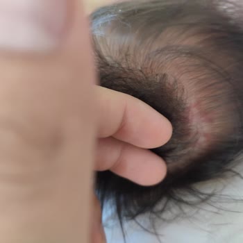 Mustela Cleansing Yenidoğan Şampuanı Ve Stelatopia Krem Pişmanlıktır