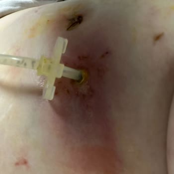 Medinova Hastanesi Genel Cerrahi Doktoru Hayatımı Mahvetti