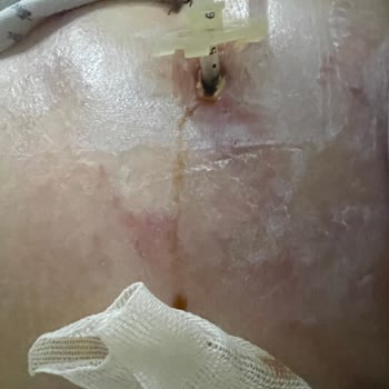 Medinova Hastanesi Genel Cerrahi Doktoru Hayatımı Mahvetti