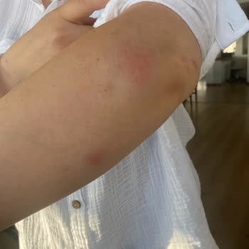 SSC Tur Doğu Karadeniz Turumuzu Mahvetti